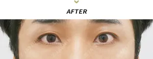 After