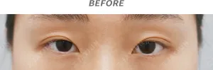 Before