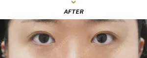 After