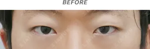 Before