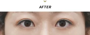 After
