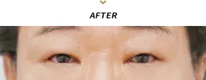 After