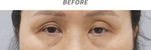 Before