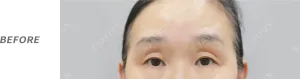 Before