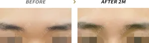 Before