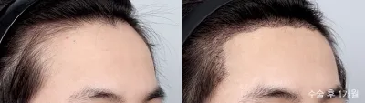 Before & After