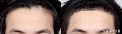Before & After
