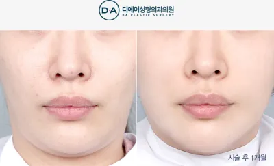 Before & After