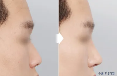 Before & After