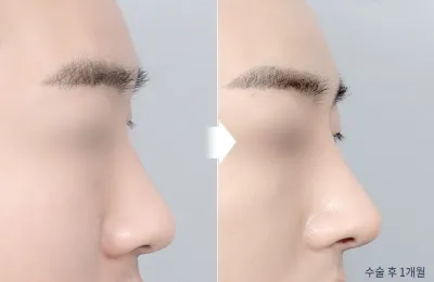 Before & After
