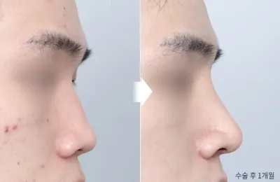 Before & After