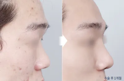 Before & After