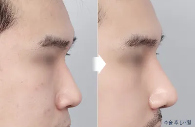 Before & After