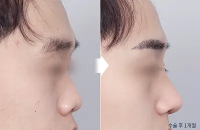Before & After
