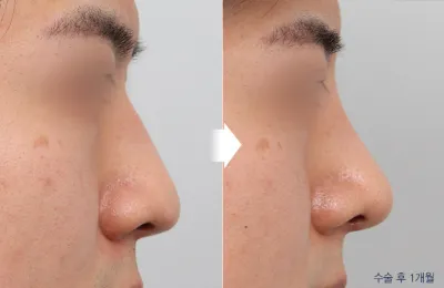 Before & After