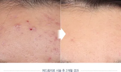 Before & After