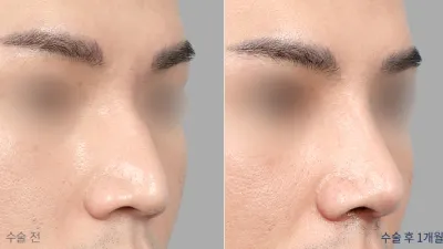 Before & After