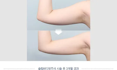 Before & After