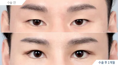 Before & After