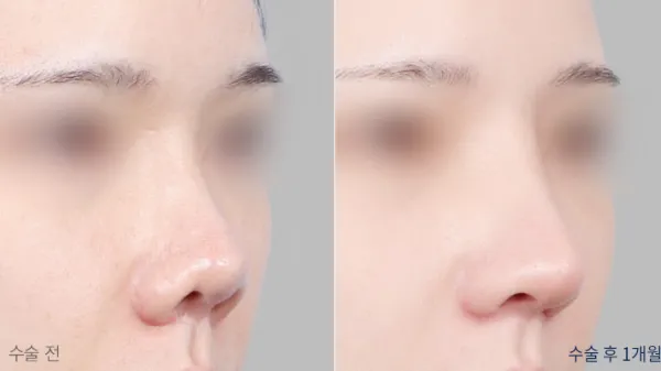 Before/After