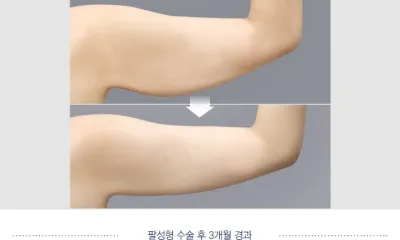 Before & After