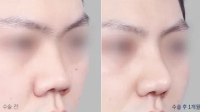 Before & After
