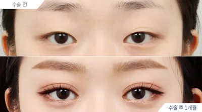 Before & After