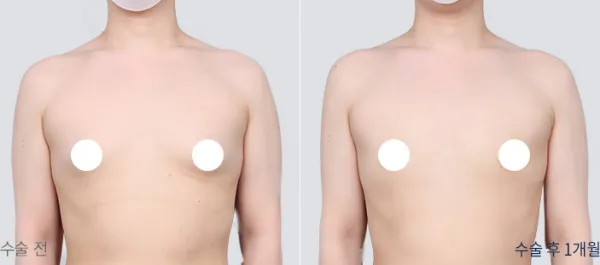 Before/After