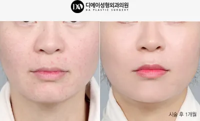 Before & After