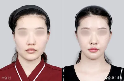 Before & After