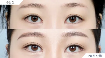 Before & After