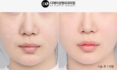 Before & After