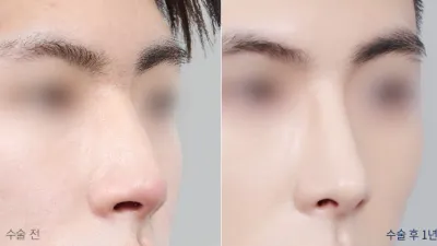 Before & After