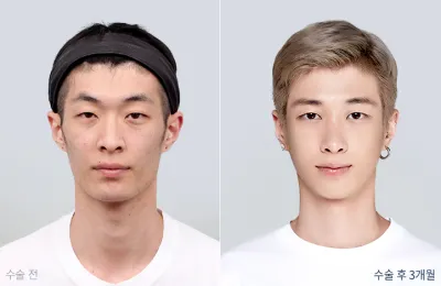 Before & After