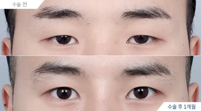 Before & After