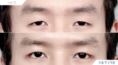 Before & After