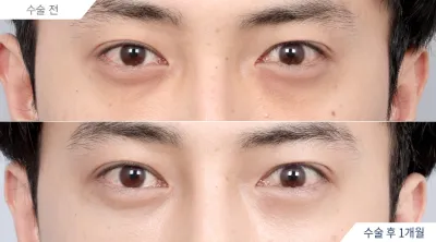 Before & After