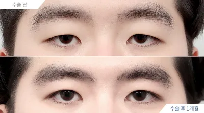 Before & After