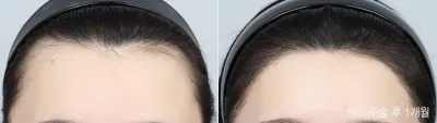 Before & After