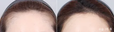Before & After