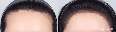 Before & After