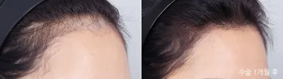 Before & After