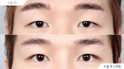 Before & After