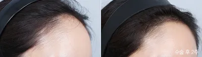 Before & After