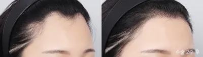 Before & After