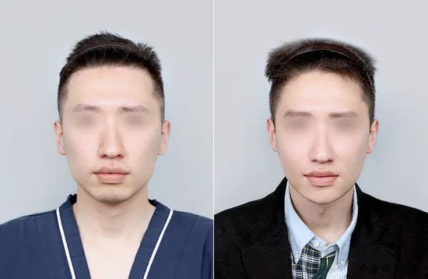 Before/After