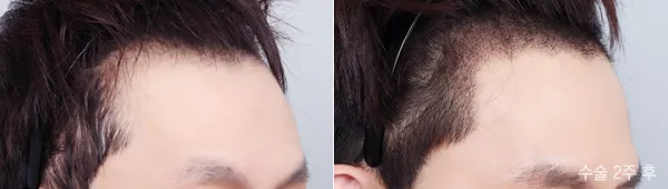 Before/After