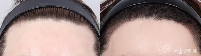 Before & After