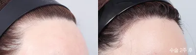 Before & After