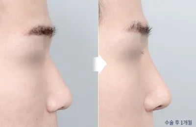 Before & After